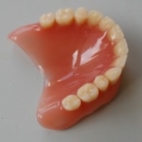 Celková snímatelná zubní náhrada