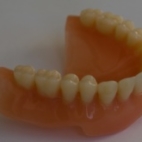 Celková snímatelná zubní náhrada